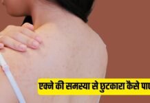 पीठ पर निकलने वाले मुंहासों से हैं परेशान? इन तरीकों से पाएं छुटकारा पीठ पर निकलने वाले मुंहासों से हैं परेशान? इन तरीकों से पाएं छुटकारा